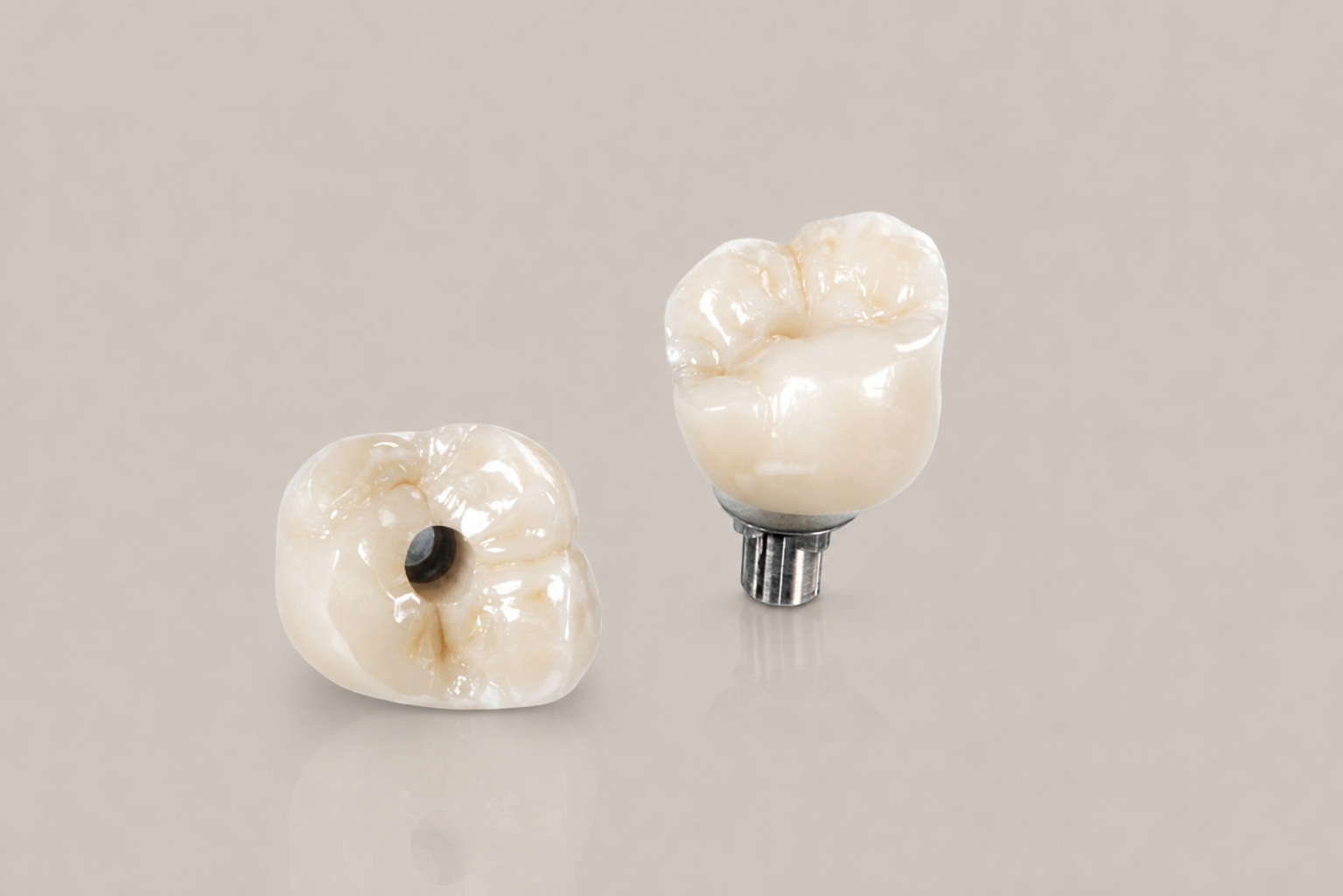 Coronas sobre implantes